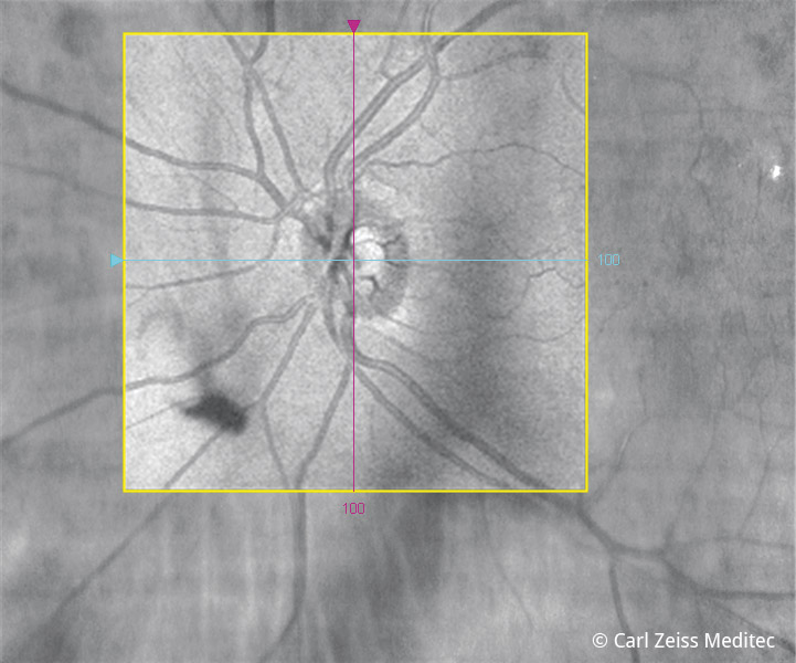 Sehnerv - EyeMedic Augenärztliche Privatpraxis Würzburg
